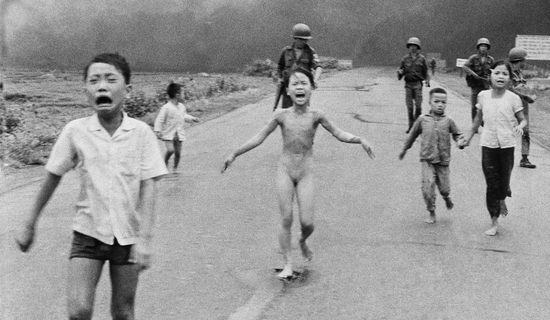 战火中的女孩赴美激光治疗 52岁的她或迎来重生_江门频道_新浪广东_新浪网