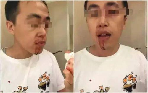 马先生被打伤，血流不止