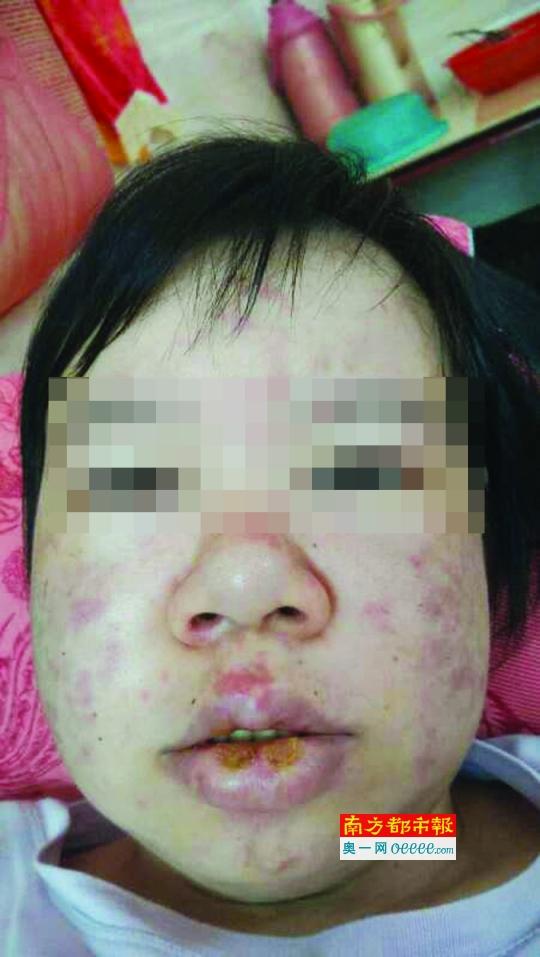 得病前後的李伙英。