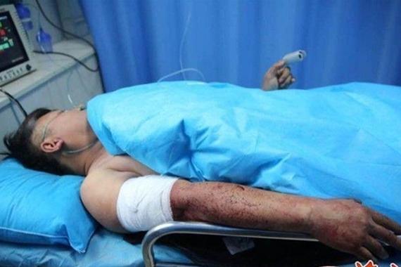 嫌前车慢捅伤司机 9岁女孩：别杀我爸爸