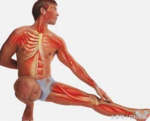 13岁女孩深蹲百次后致横纹肌溶解!网友:心安理