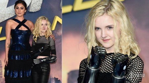 卡神这是一箭双雕啊!其团队为13岁女孩打造机械手臂