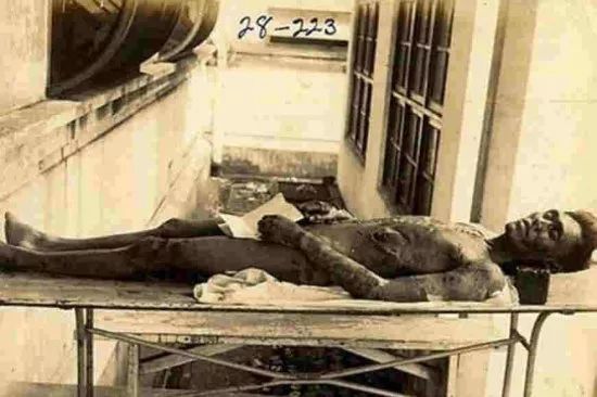 日本名教授曾活取中国抗日战士睾丸做研究向美