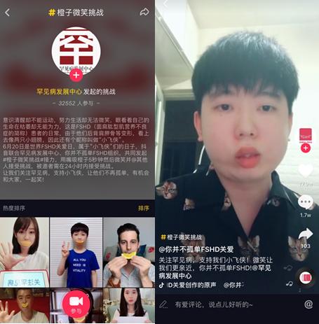抖音、今日头条同罕见病发展中心 发起FSHD行