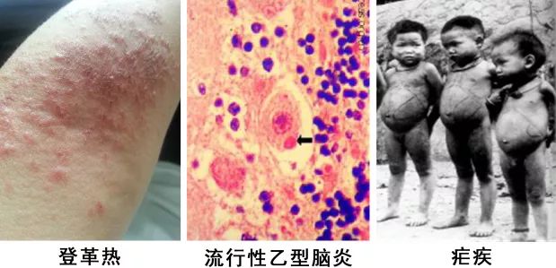 轻轻一喷这款泰国好物，蚊虫再无嚣张机会了！