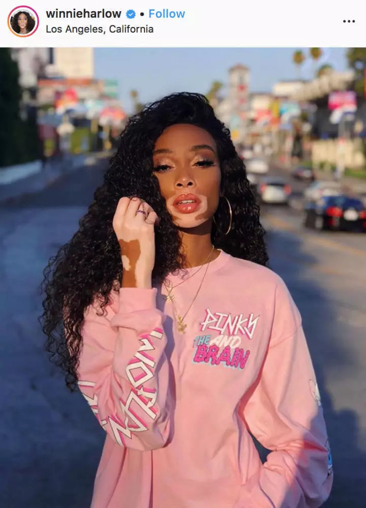 Winnie Harlow