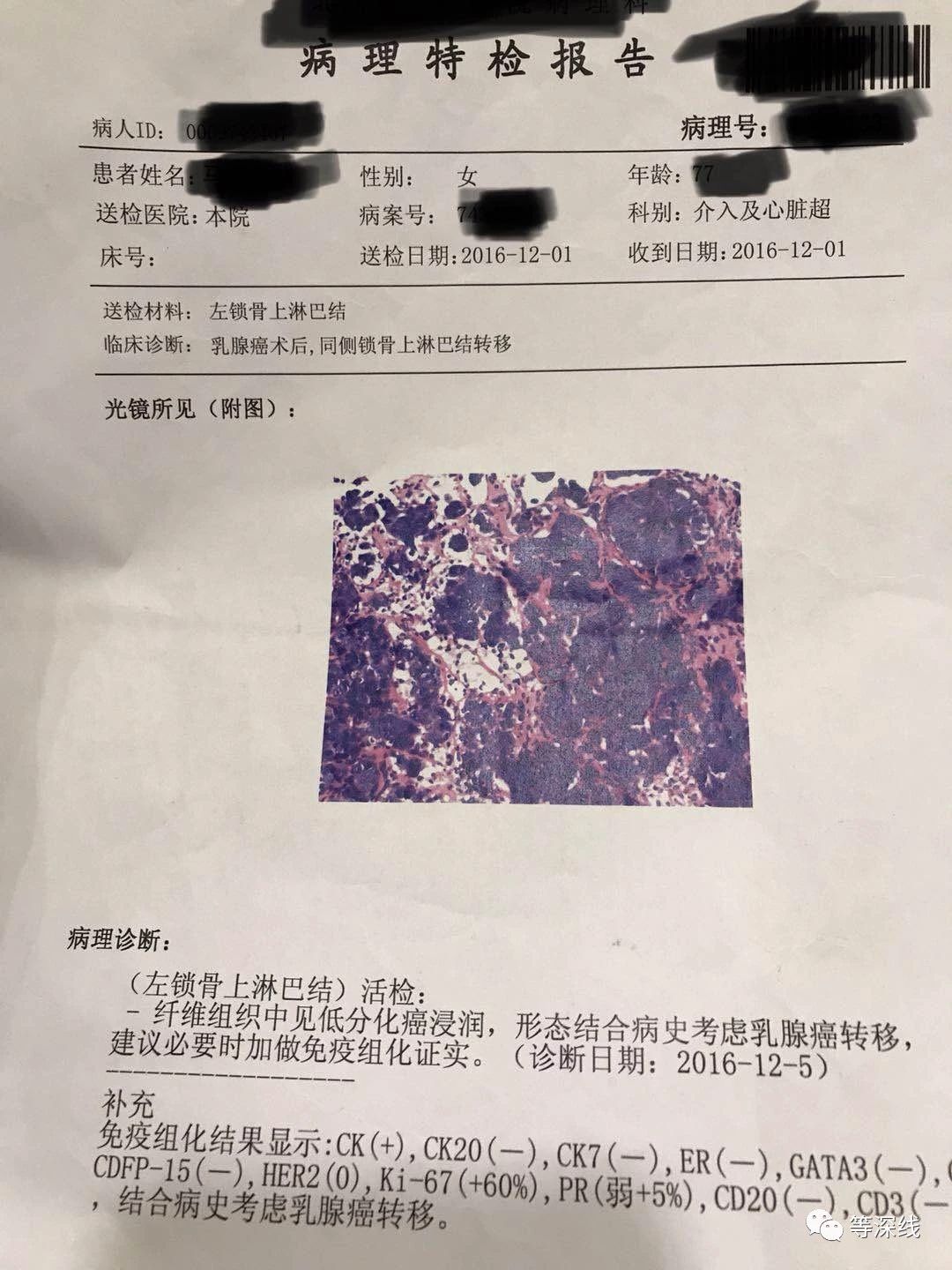 　李老師早前的檢查報告，陌生人竟然在電話中完全說對了她的情況?！兜壬罹€》記者 晏耀斌 攝