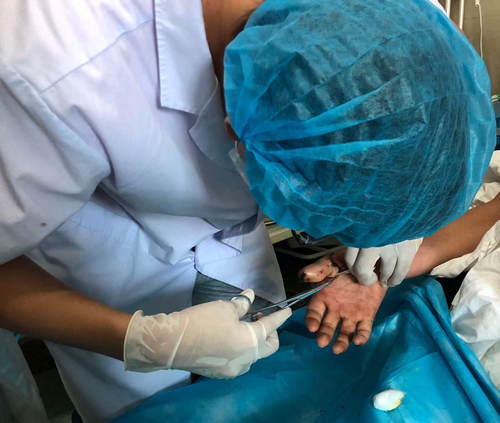 董萍整形三十五年：埋线双眼皮可以修复吗？