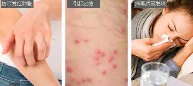 轻轻一喷这款泰国好物，蚊虫再无嚣张机会了！