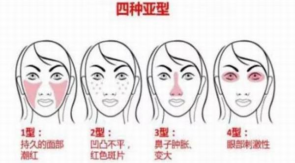 问答|怎么才能告别草莓鼻变回小仙女?