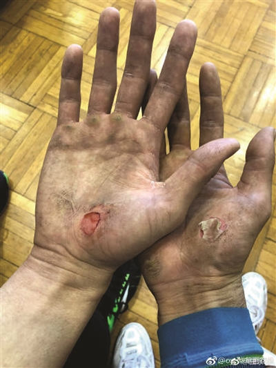 流血流汗 为何还要流泪