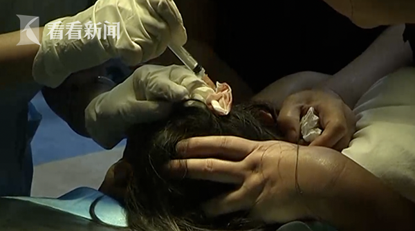 猴子突然窜进4楼居民家中 床上的宝宝惨被其狠咬