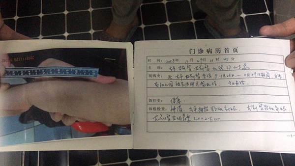 家长提供的针扎孩子病例册。遇小希供图
