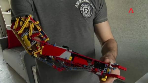 玩具除了玩还能干嘛?西班牙小伙用乐高为自己制作假肢
