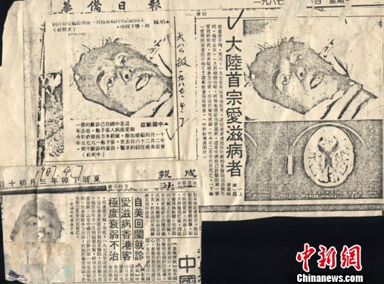 境表媒体刊发的中新社有关报道。 福建省立医院供图 摄 境表媒体刊发的中新社有关报道。 福建省立医院供图 摄
