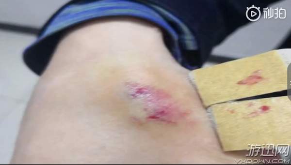13岁男孩逃学上网 母亲拿铁锤怒砸网吧咬伤民警被刑拘