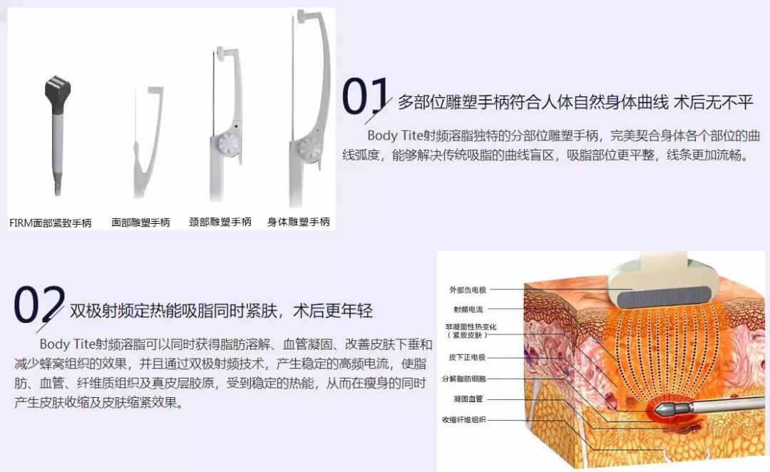 射频技术
