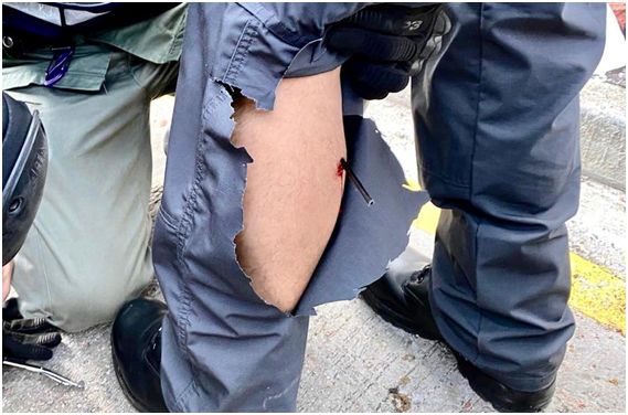 (警察传媒联络队(FMLC)队员中箭,图源:香港警察脸书)