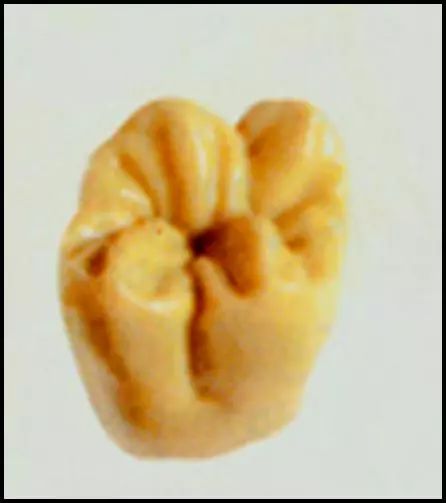 @佛山家长!7月起带孩子去做窝沟封闭,免费!关