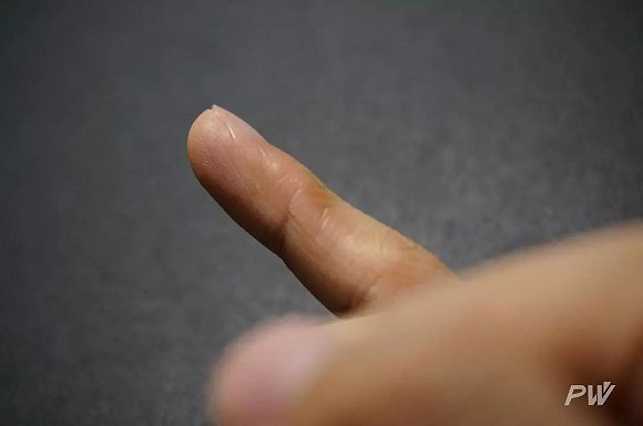 【博狗扑克】从锄头到手机:手茧见证了四代生产力工具的迭代 【博狗扑克】从锄头到手机:手茧见证了四代生产力工具的迭代