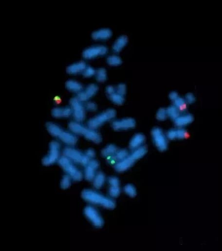 中期细胞荧光原位杂交里呈现的费城染色体