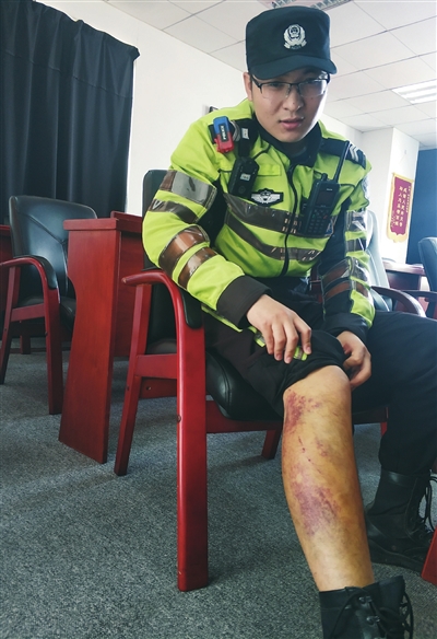 辅警张东东在执法非法行驶的摩托车时导致腿部受伤。 辽沈晚报、聊沈客户端记者 王迪 摄