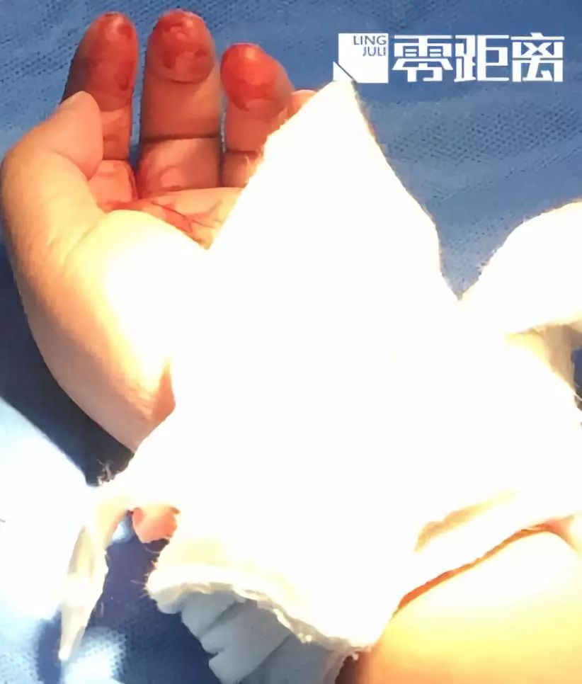 幼童被咬父亲摔死泰迪遭网友死亡威胁,孩子妈