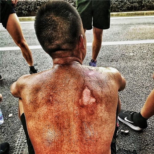 福建90后消防员受伤背影刷屏 但别搞错了真相