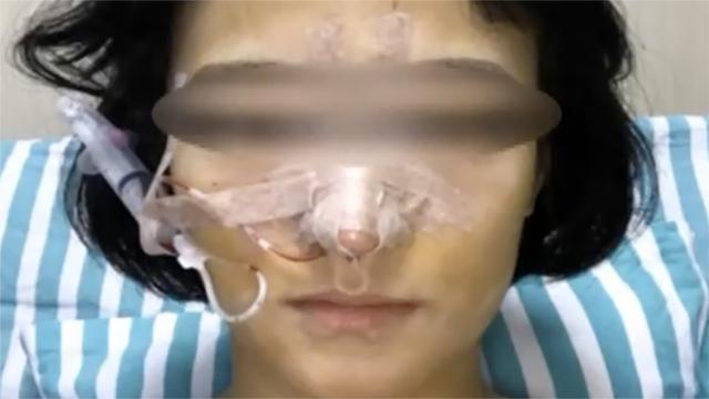 女主播花4万垫鼻不料变“匹诺曹” 开直播被网友怼：你想戳死谁
