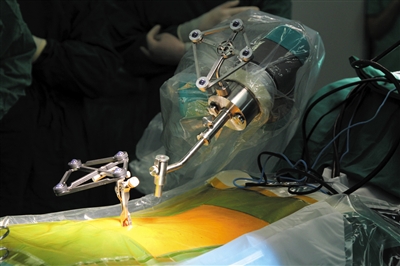 脊柱手术进入精准时代|手术|机器人|患者