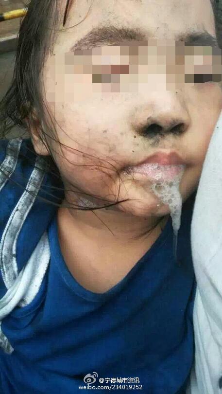 福建宁德一幼儿园起火 多名被困儿童送医治疗