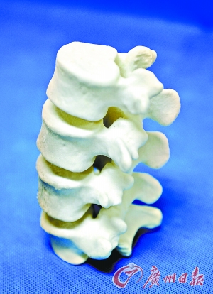 3D打印真可以脱胎换骨|骨科|技术|3D打印_业界