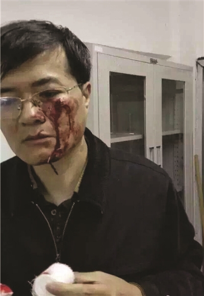 不满物业服务,业委会欲重新招标 小区居民频受