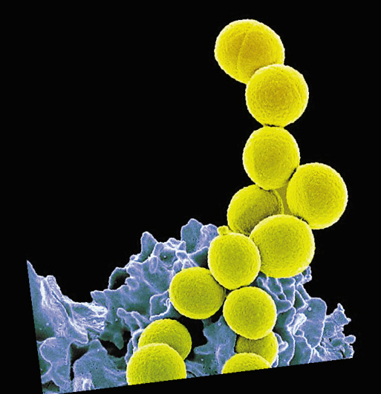  广州 地铁 检出超级细菌 | 广州 地铁|样本|细菌_新