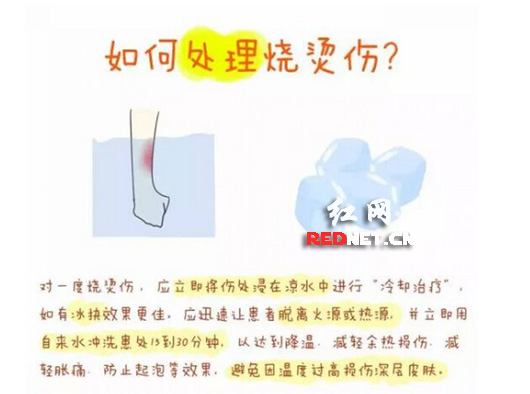 巴黎遇袭 中南大学女生发布漫画教你处理烧烫