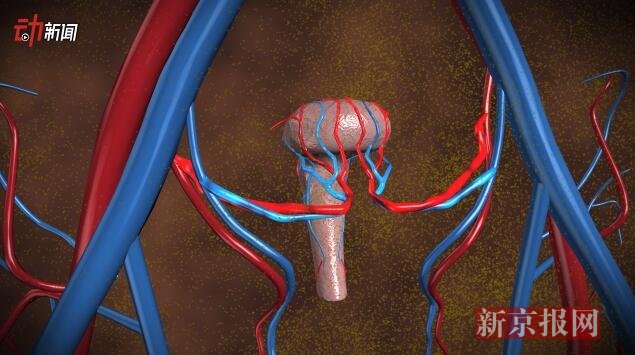 母亲把子宫移植女儿 3D还原机器人辅助手术过