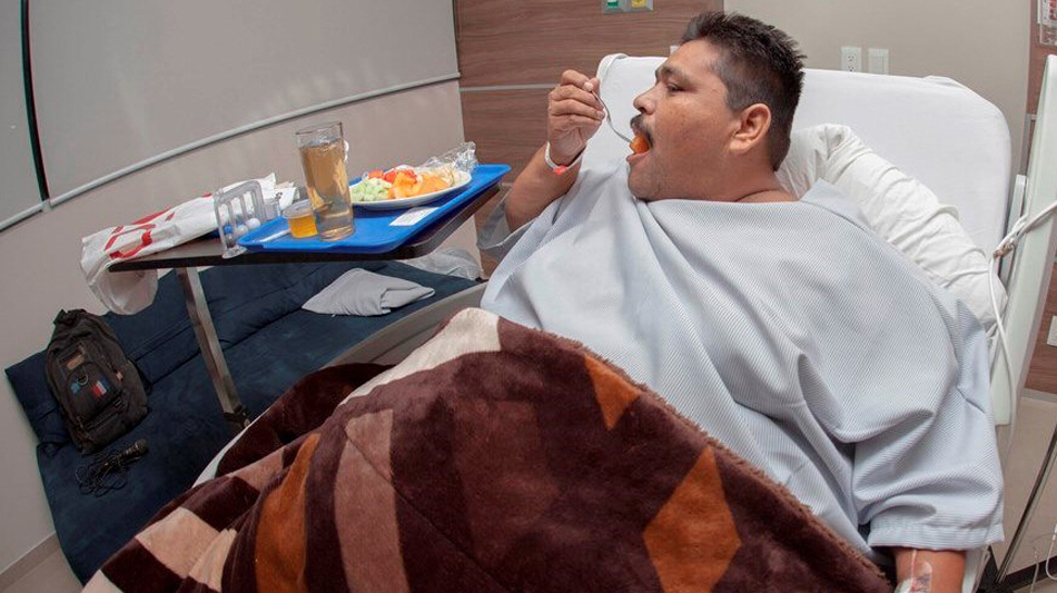 世界最胖男子减肥手术后患疝气 被迫切除80厘