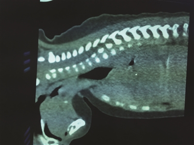3个月男婴莫名呕吐6天险丧命 竟因3岁姐姐好