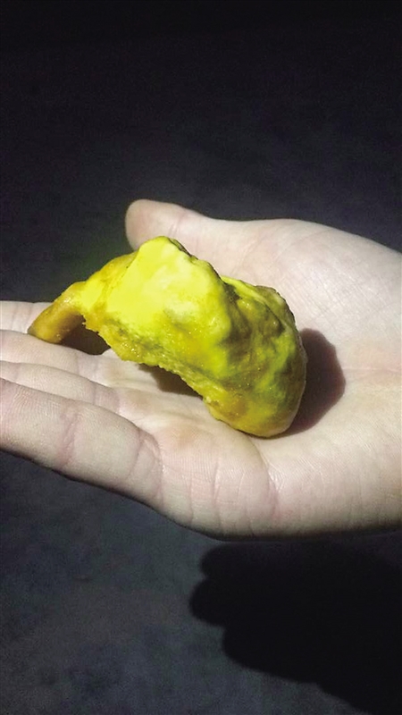 鸡肚子里取出两个黄疙瘩 市民打飞的到上海鉴