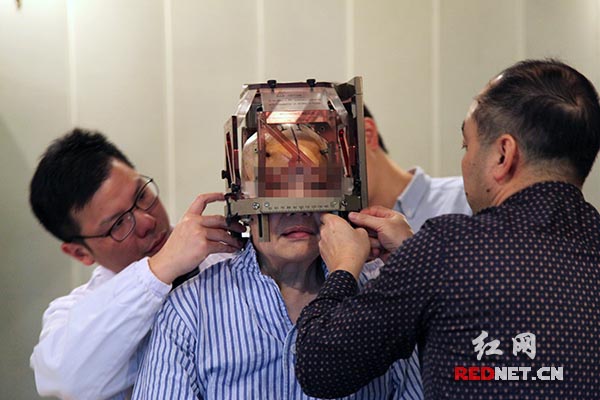 湖南省脑科医院使用脑起搏器治疗外伤型精神障碍