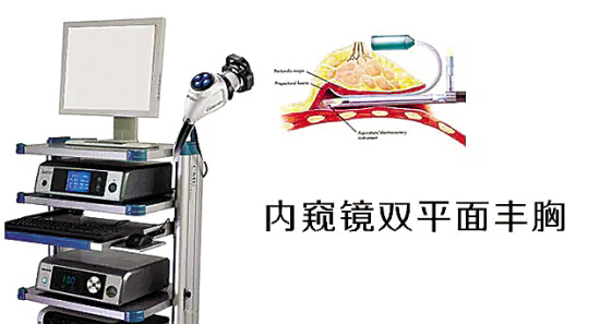 网络女主播公开广州微创丰胸手术