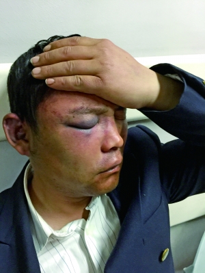 昨天，北京晨报记者问起事发一幕，保安小周却说什么都不记得了，只忍痛给记者比划了一个拳头砸向面部的姿势，意思是当时对方一拳将他击倒，“我听他们说了句‘打的就是你’，后面就啥也不知道了”。张静姝/摄