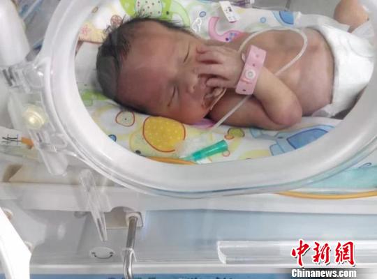 图为在医院保温箱接受治疗的刘楠的大儿子“大宝” 受访者供图 摄
