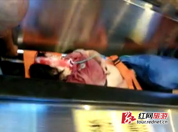 一女游客在天门山被落石砸伤 伤者正被抢救