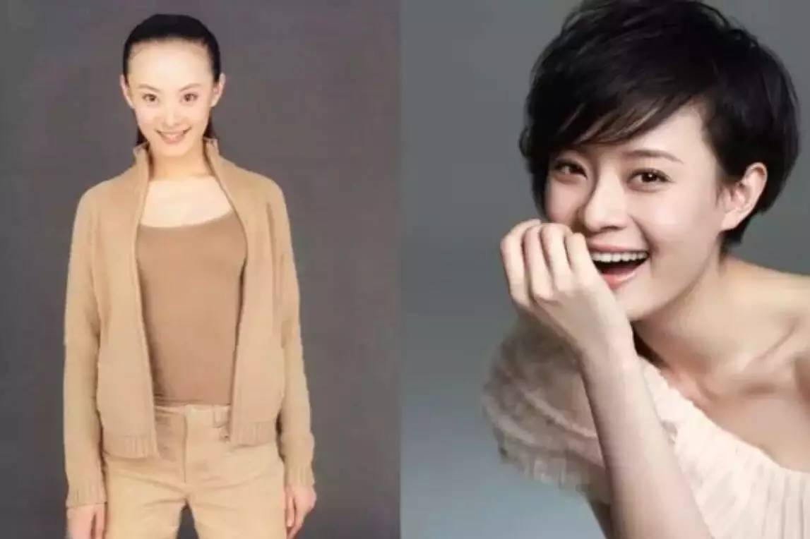 章子怡杨幂等女星发际线怎么越来越高?|章子怡|杨幂|佟丽娅_新浪娱乐_新浪网