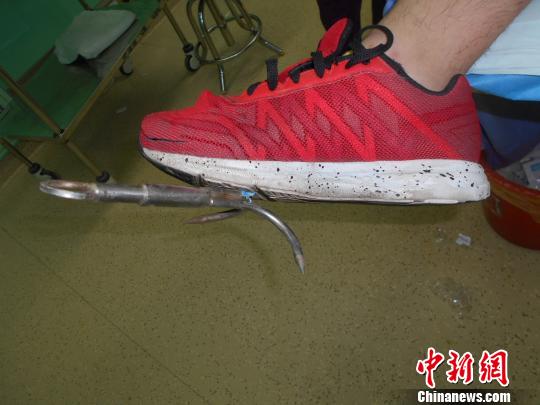 徐州少年玩密室逃脱刺穿脚掌 游乐场安全敲警