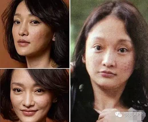 明星烂脸真可怕!简单粗暴,专治一脸爆痘痤疮|祛