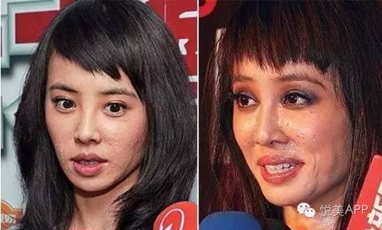 明星烂脸真可怕!简单粗暴,专治一脸爆痘痤疮|祛