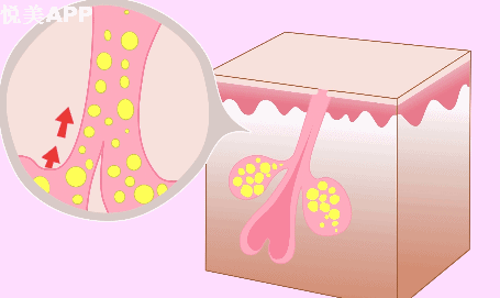 明星烂脸真可怕!简单粗暴,专治一脸爆痘痤疮|祛