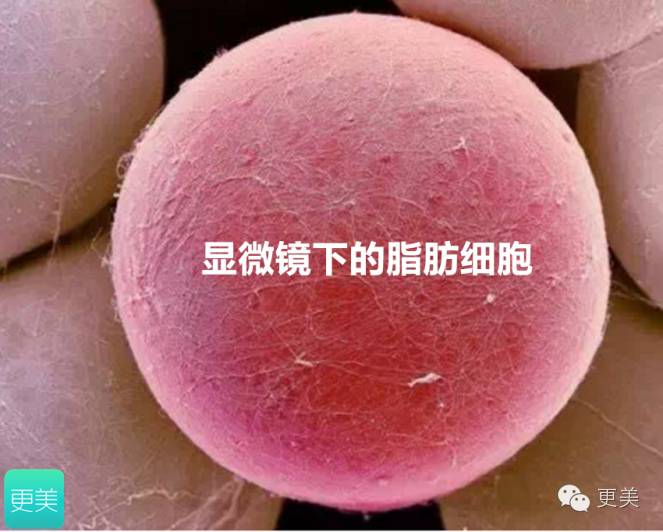 减肥不减胸,形体美才是真的美!|水动力吸脂|负压